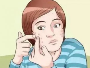 脸上长痘痘去医院挂什么科